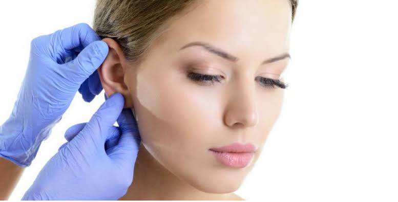 Read more about the article Earlobe Repair