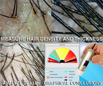 Pandit Clinic Hair Analysis with caslite