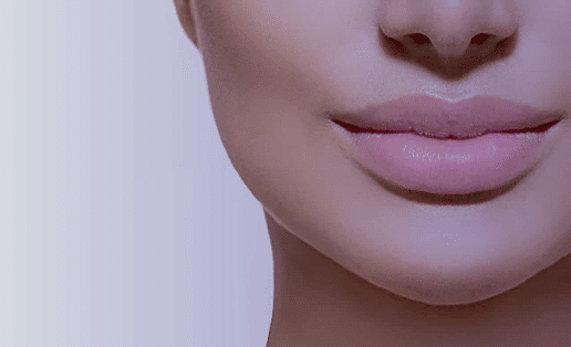 lip augmentation