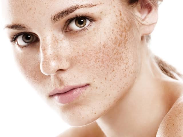 Read more about the article Skin Pigmentation