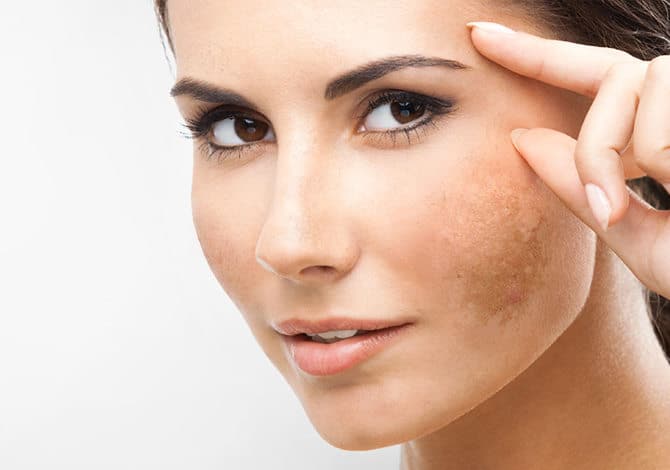 skin pigmentation skin pigmentation