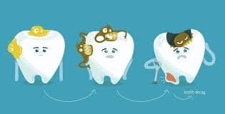 tooth decay in kids