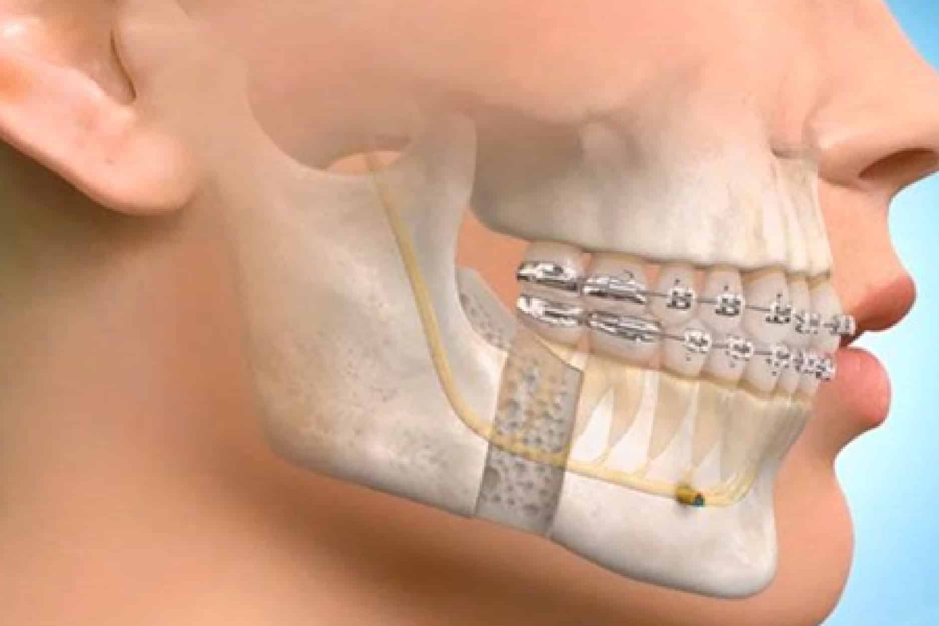 Why Should You Go To An Oral & Maxillofacial Surgeon For Your Dental Complications?