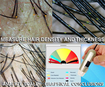 caslite hair analysis