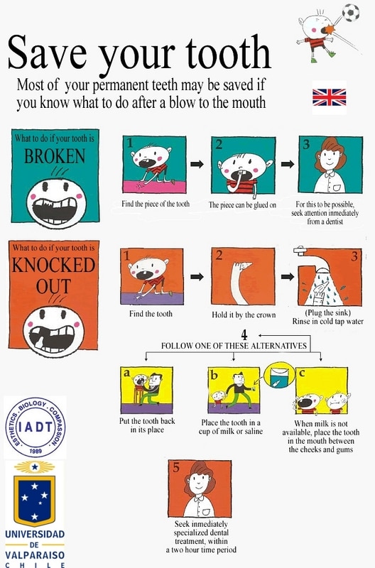 save your tooth English