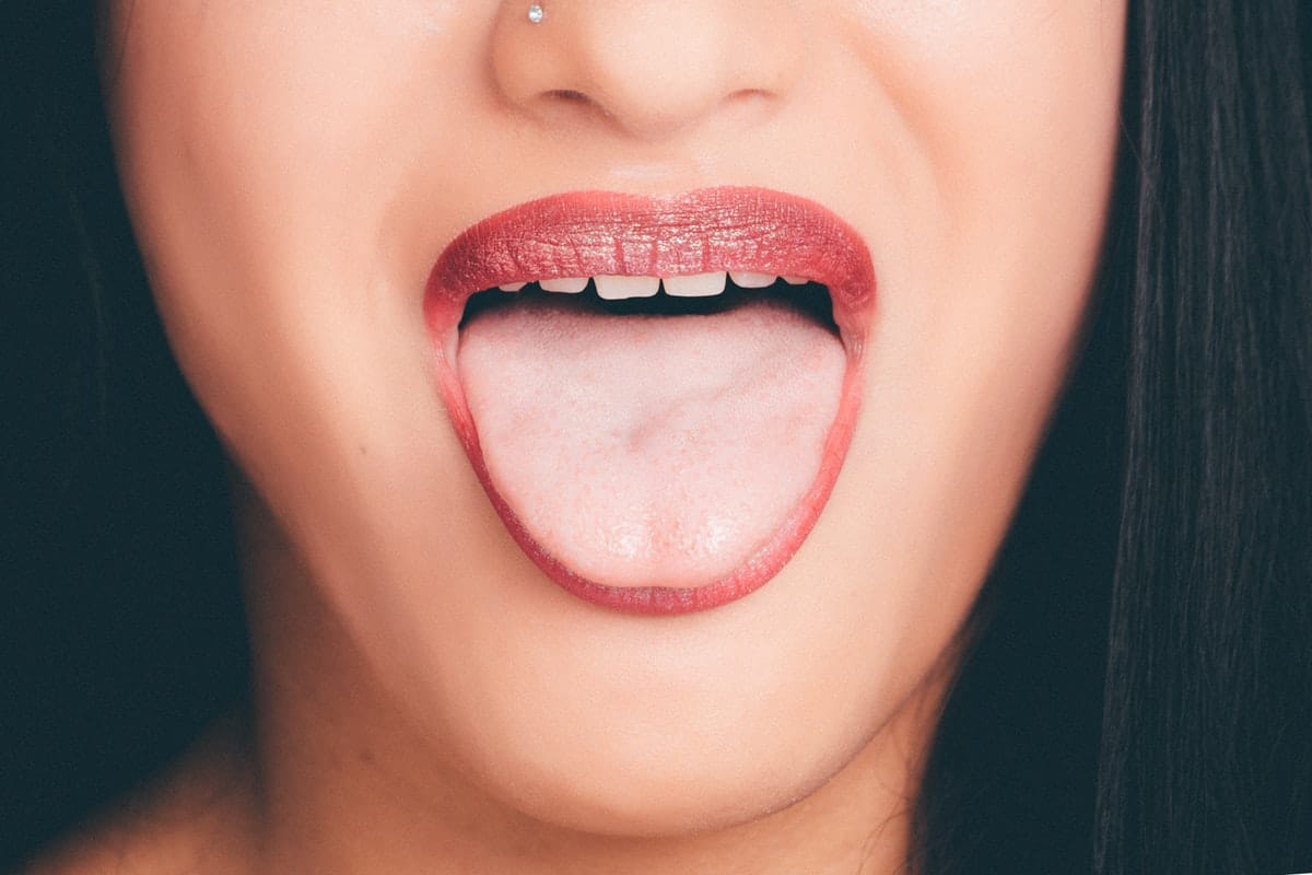 Read more about the article Tongue Tie Surgery: Procedure, Risks & Surgical Methods