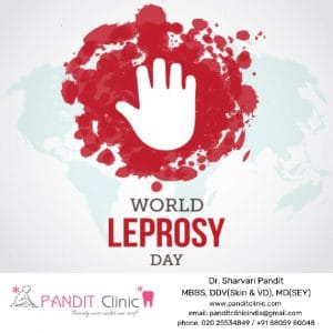 Pandit-Clinic-Leprosy-Day-Option