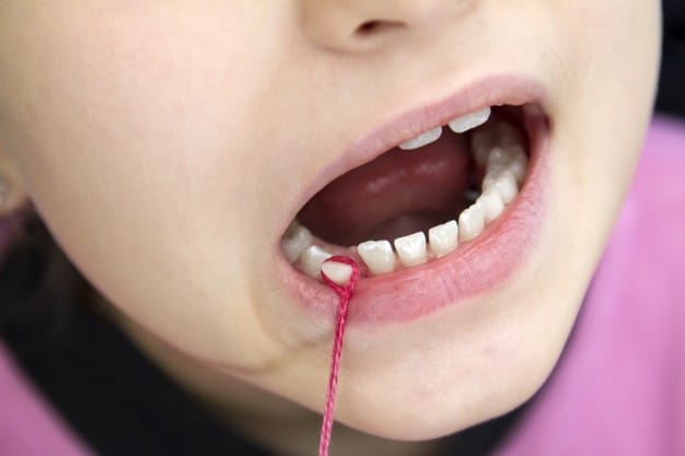Tooth Extraction in Children – Causes, Preparation, Procedure