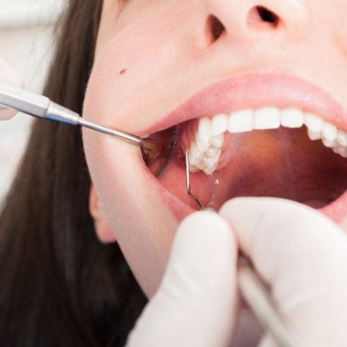 gum surgery