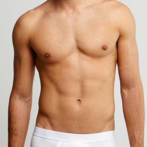 gynecomastia gynecomastia