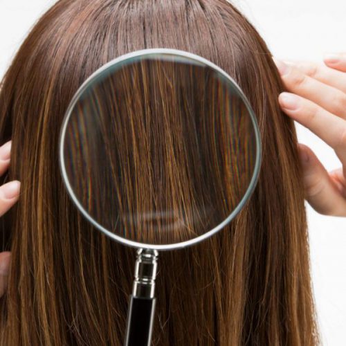 hair analysis hair analysis