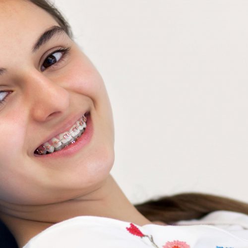 orthodontics for kids Orthodontics, braces for kids